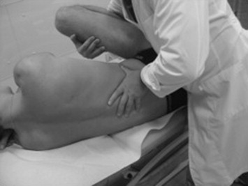 Fascial Hernia Lower Leg