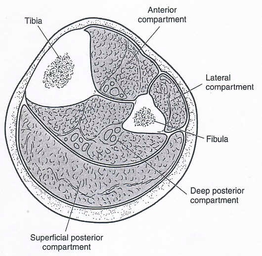 Fascial Hernia Shin