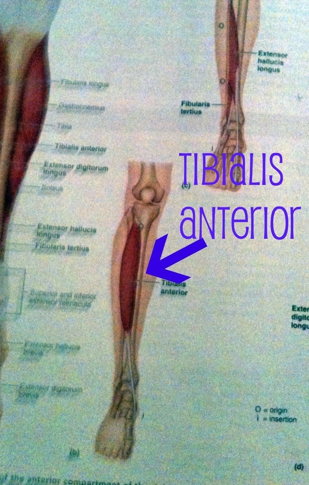 Fascial Hernia Shin