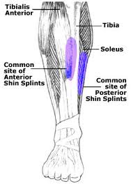 Fascial Hernia Shin