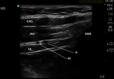 Fascial Hernia Surgery