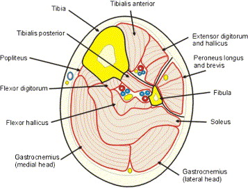 Fascial Herniation In Lower Leg