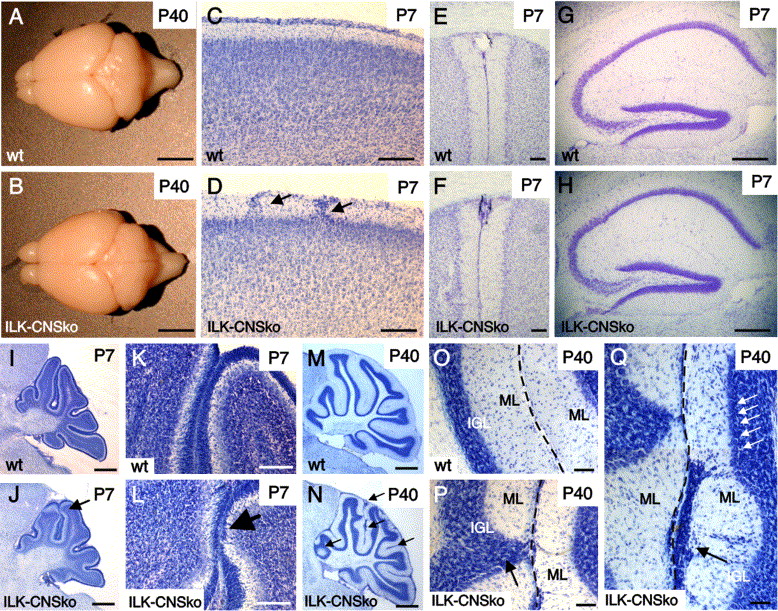 The Cerebral Cortex Accounts For Approximately What Percentage Of The Brain