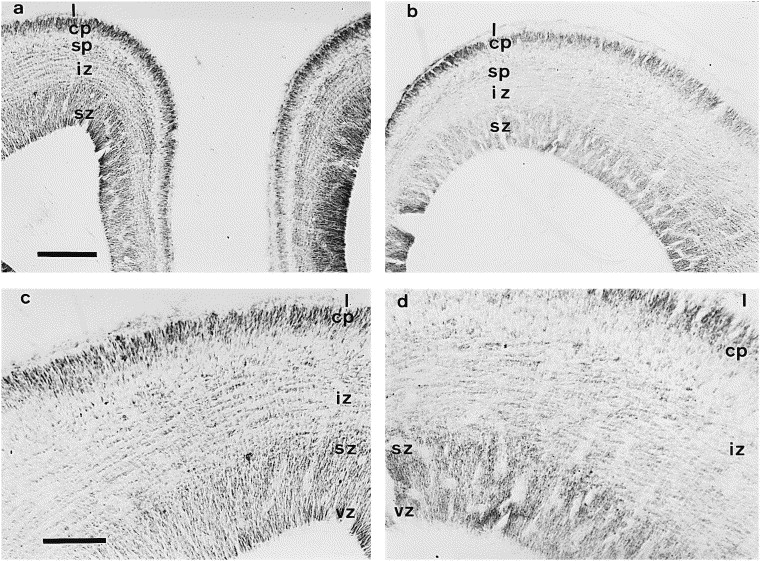 The Cerebral Cortex Appears To Be Responsible For