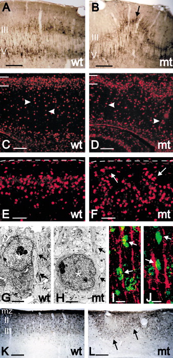 The Cerebral Cortex Is The Covering Layer Of The